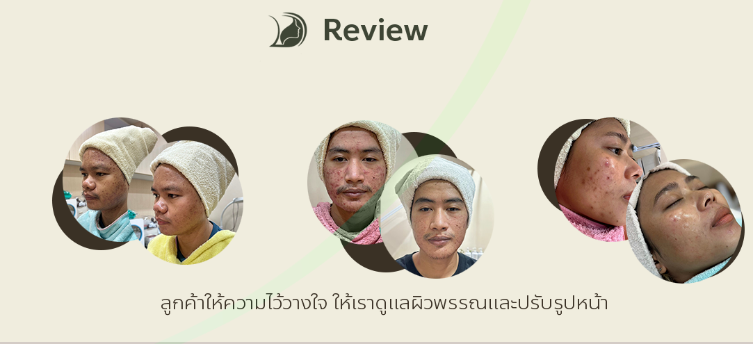 review