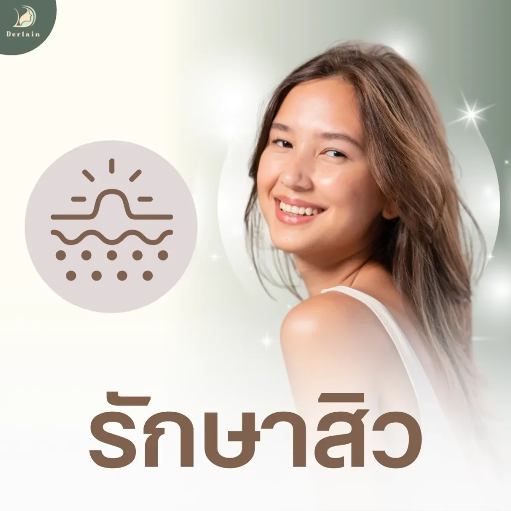 บริการรักษาสิว เดอร์เลนคลินิก