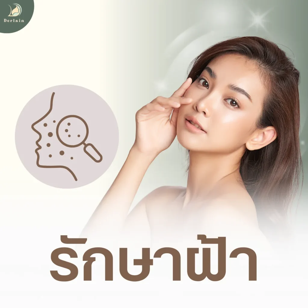 บริการของเดอร์เลนคลินิก - รักษาฝ้า
